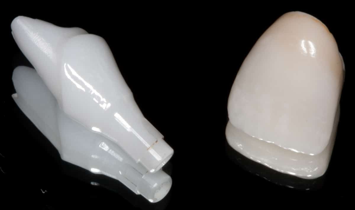 A pair of white teeth on a black surface, emphasizing the expertise of Denver prosthodontist Aldo Leopardi.