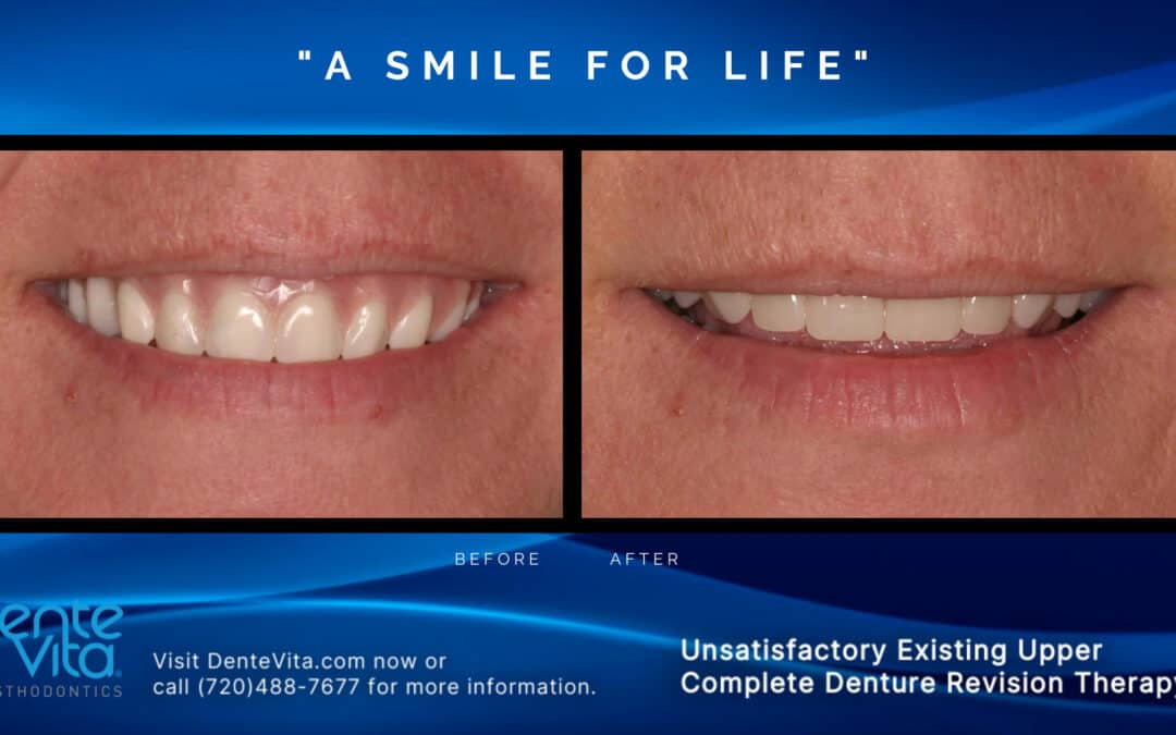 Case Studies Page 2 DenteVita Prosthodontics Aldo Leopardi BDS